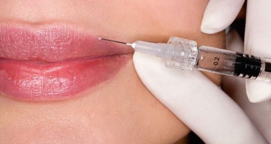 Одеситки масово роблять "уколи" краси