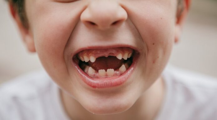 Лікування карієсу у дітей: сучасні методи