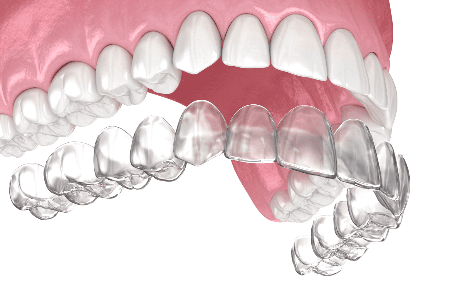 елайнери в Одесі